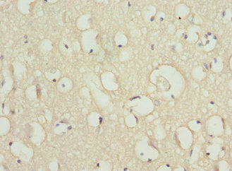 SCN2B Antibody
