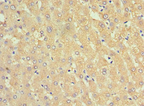 SERPINA3 Antibody