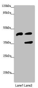 SERPINB6 Antibody