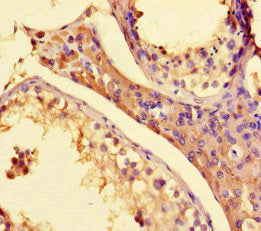 SETD1A Antibody