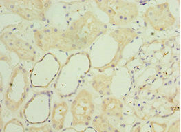 SGSH Antibody