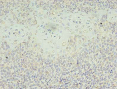 SH3BGRL Antibody