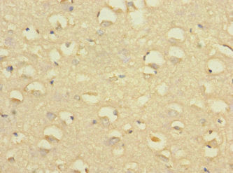 SLC24A1 Antibody