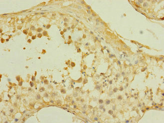 SLCO2B1 Antibody