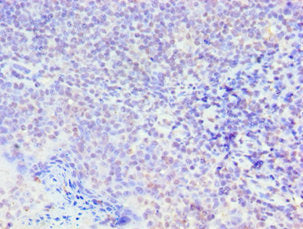 SMAD9 Antibody