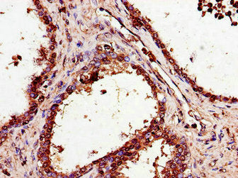 SMS Antibody