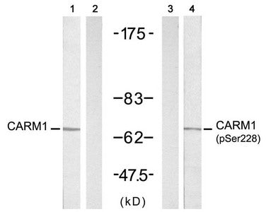 CARM1 (Ab-228) Antibody