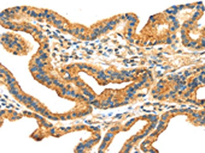 RRAGA Antibody
