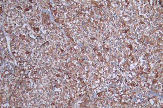 SOAT1 Antibody