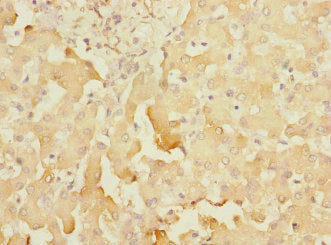 SOAT2 Antibody