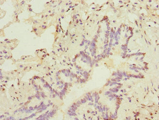 SOX5 Antibody