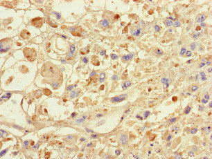 SPAG9 Antibody