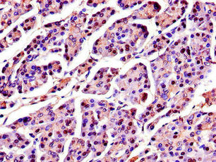 SPINK1 Antibody
