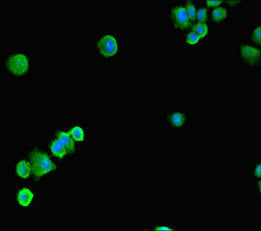 SSRP1 Antibody