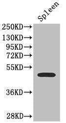 SSTR2 Antibody