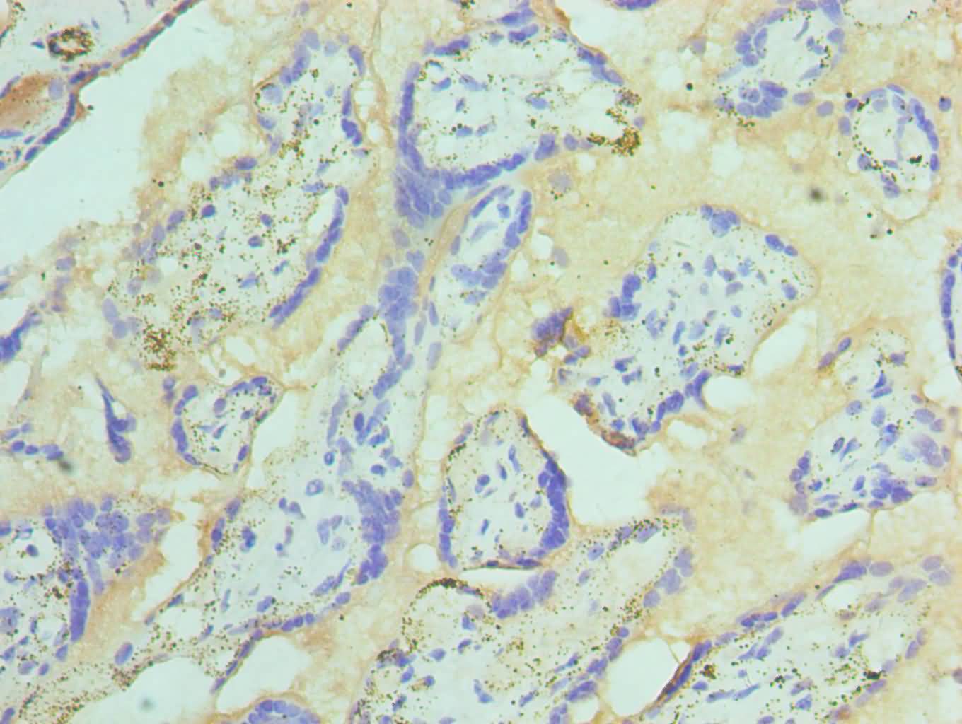 ST14 Antibody
