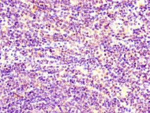 STIM1 Antibody