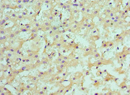 SULT2A1 Antibody