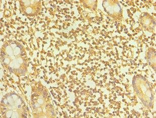 TAC1 Antibody