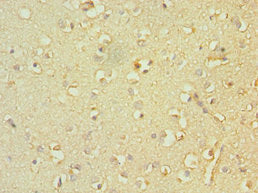 TACR3 Antibody
