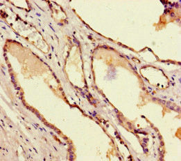 TAF6 Antibody