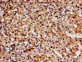 TBC1D4 Antibody