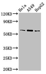 TBL1X Antibody