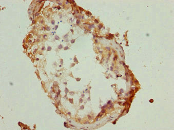 TBPL1 Antibody