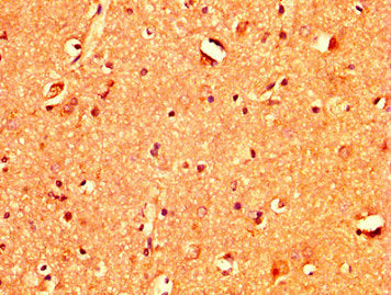 TBX3 Antibody