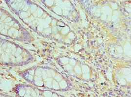 TFDP1 Antibody