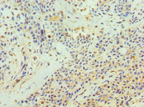 TFPI2 Antibody