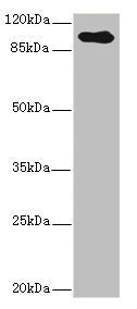 TGFBR3 Antibody