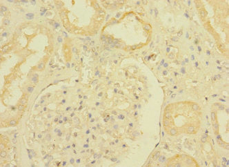 TGFBR3 Antibody