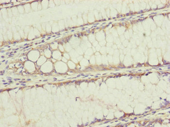TIMM17B Antibody