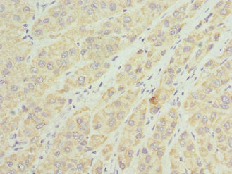 TIMM8A Antibody