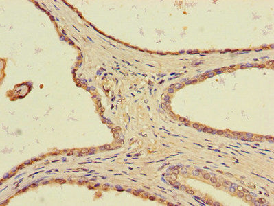 TLL1 Antibody