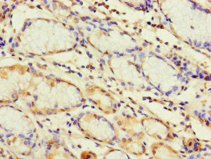 TLR1 Antibody