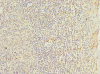TM9SF3 Antibody
