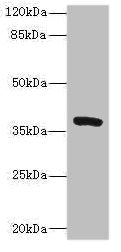 TMEM64 Antibody
