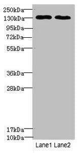 TPP2 Antibody