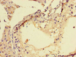 TPPP3 Antibody