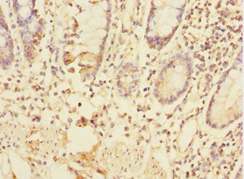 TRIAP1 Antibody