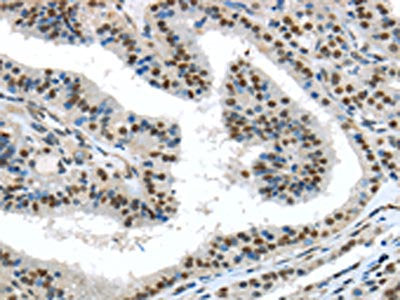 TKT Antibody