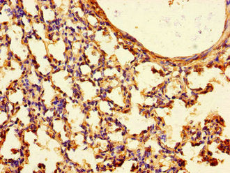TTLL8 Antibody