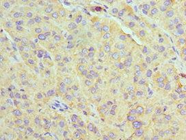 U2AF1 Antibody