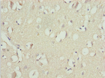 UBA6 Antibody