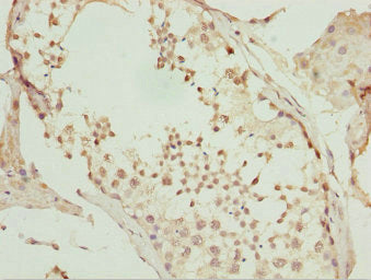 UBA6 Antibody