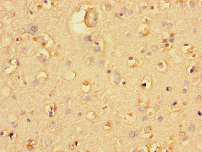 UBA6 Antibody