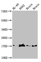 UBE2V2 Antibody
