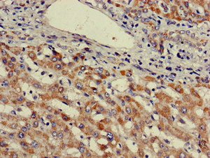 UBE3A Antibody